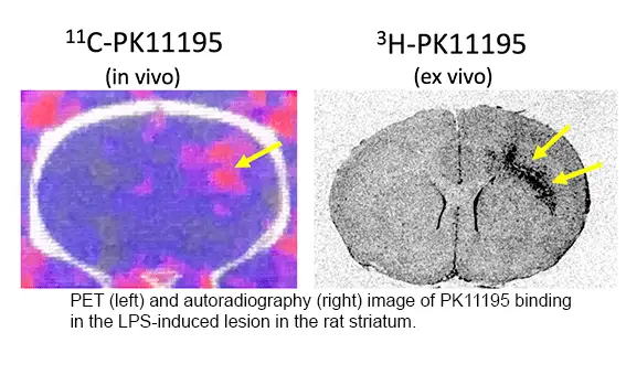 TSPO PET & autoradiography