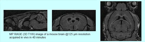 T1W (MP-RAGE) MRI of the mouse brain