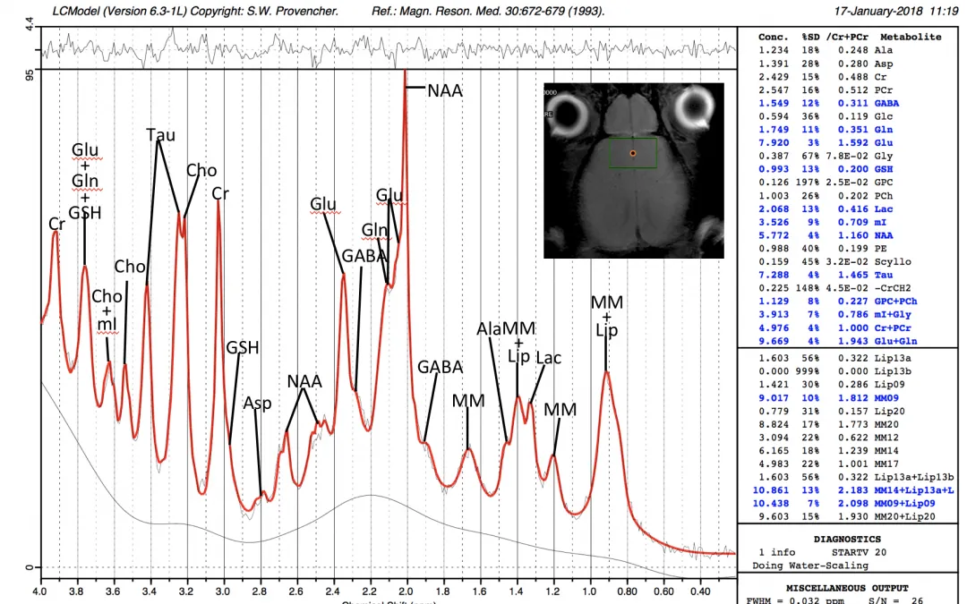 MR spectrum of the mouse prefrontal cortex